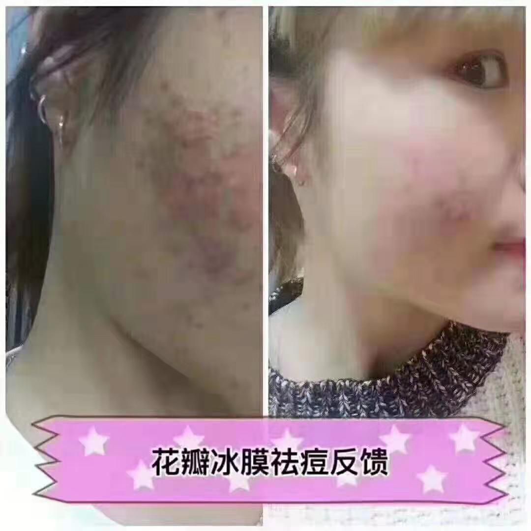 花瓣面膜大人小孩都可以用