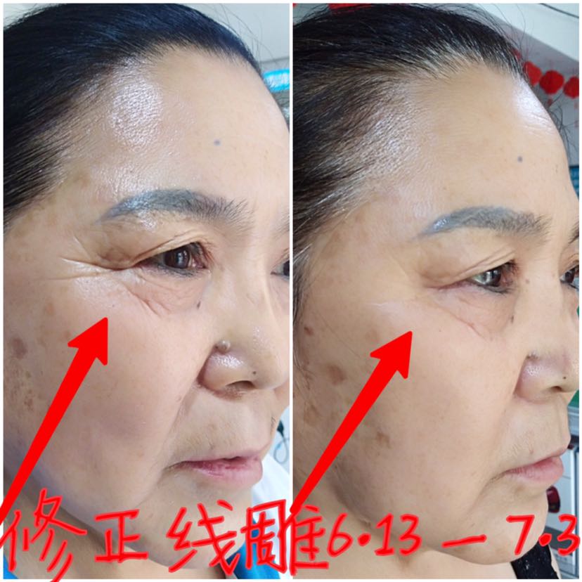修正药业集团护肤品系列