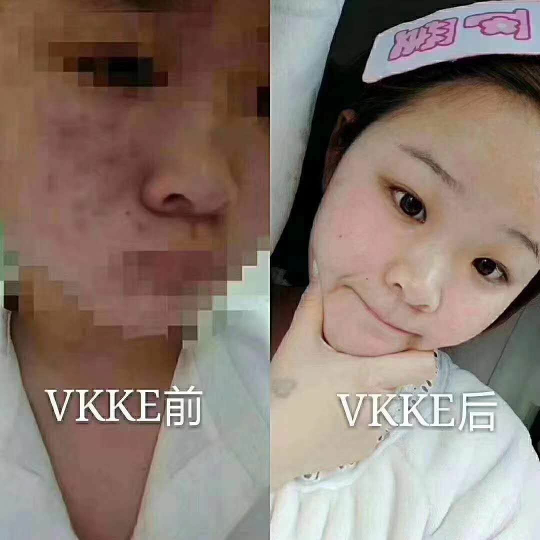 牛奶布丁奶霜美白淡斑补水去痘印，皮肤干起皮都可以找我