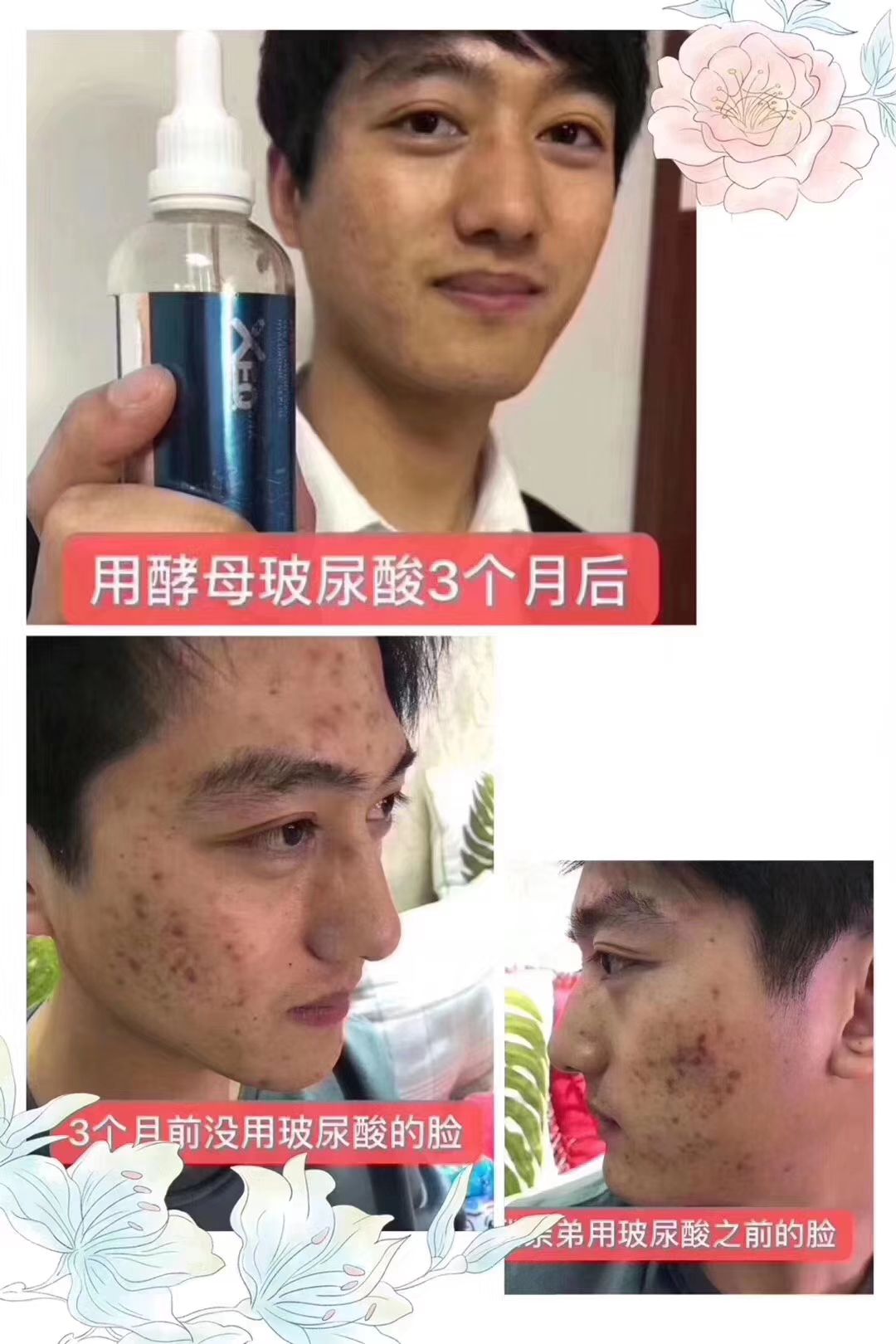 酵母玻尿酸♥孕妇小孩都可以用。