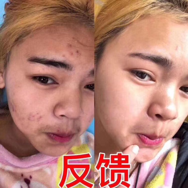 自用产品欧束诚招代理一对一培训指导对接各大网红