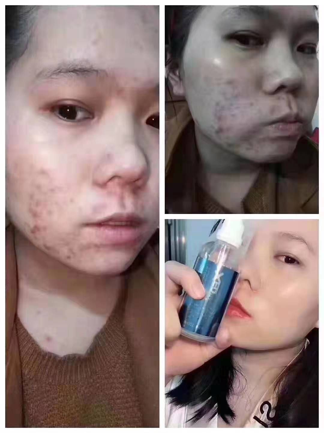 酵母玻尿酸♥孕妇小孩都可以用。