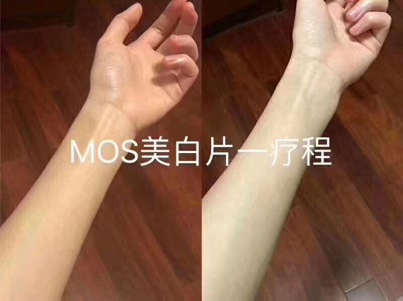美白片 减肥 美妆 面膜 气垫 洁面慕斯