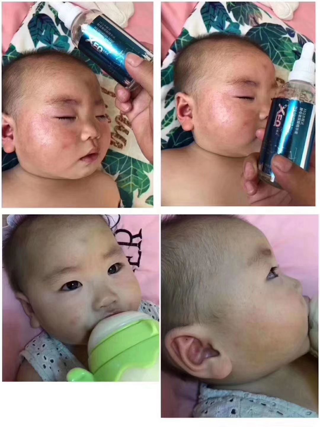 酵母玻尿酸♥孕妇小孩都可以用。