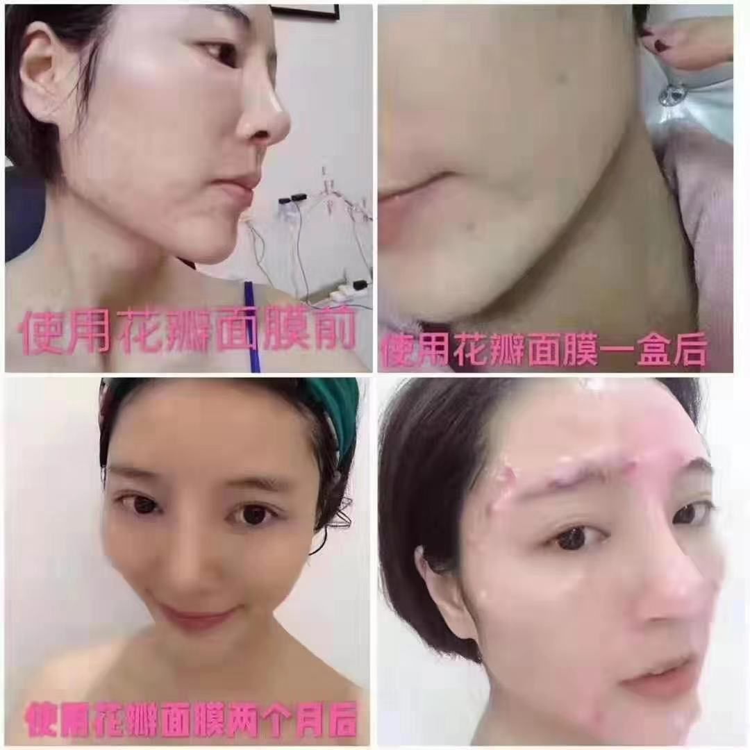 冰亦花瓣面膜 纯牛奶调制