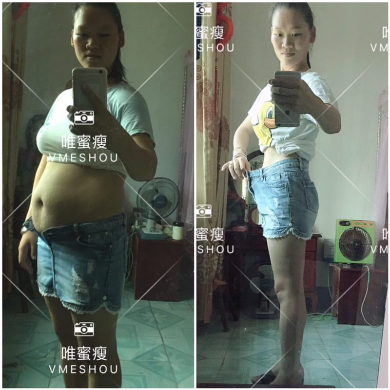 健康减肥唯蜜瘦  不打针 不吃药 不节食