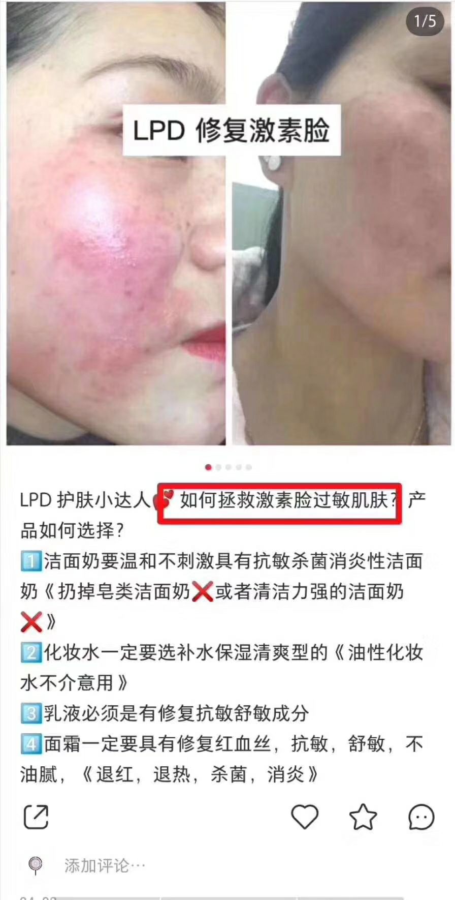 LPD莱派蒂护肤品