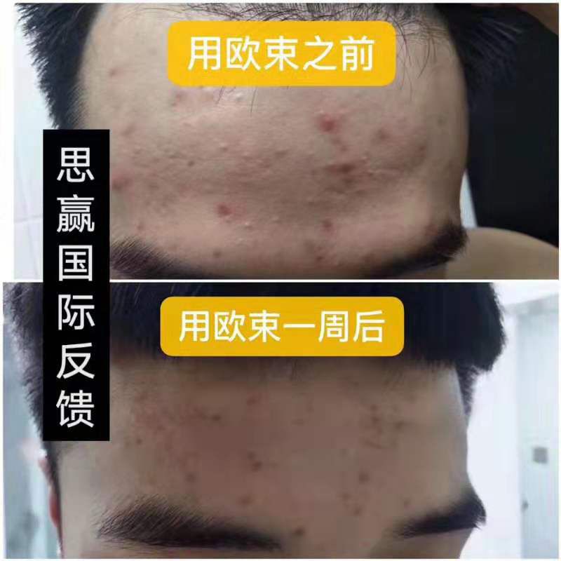 欧束洁面慕斯   水和乳。