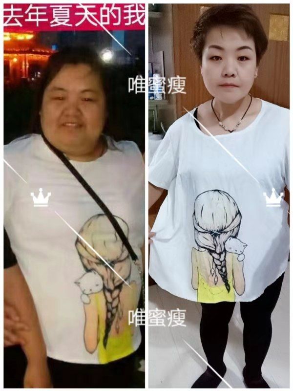 唯蜜瘦瘦身包