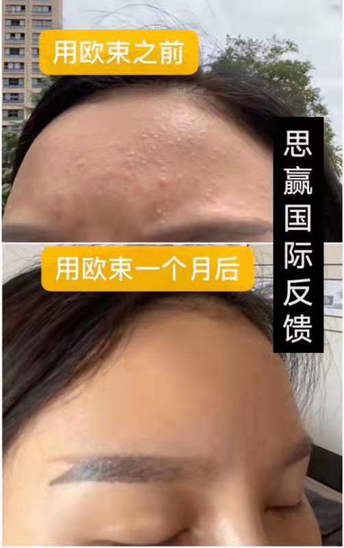 欧束洁面慕斯   水和乳。