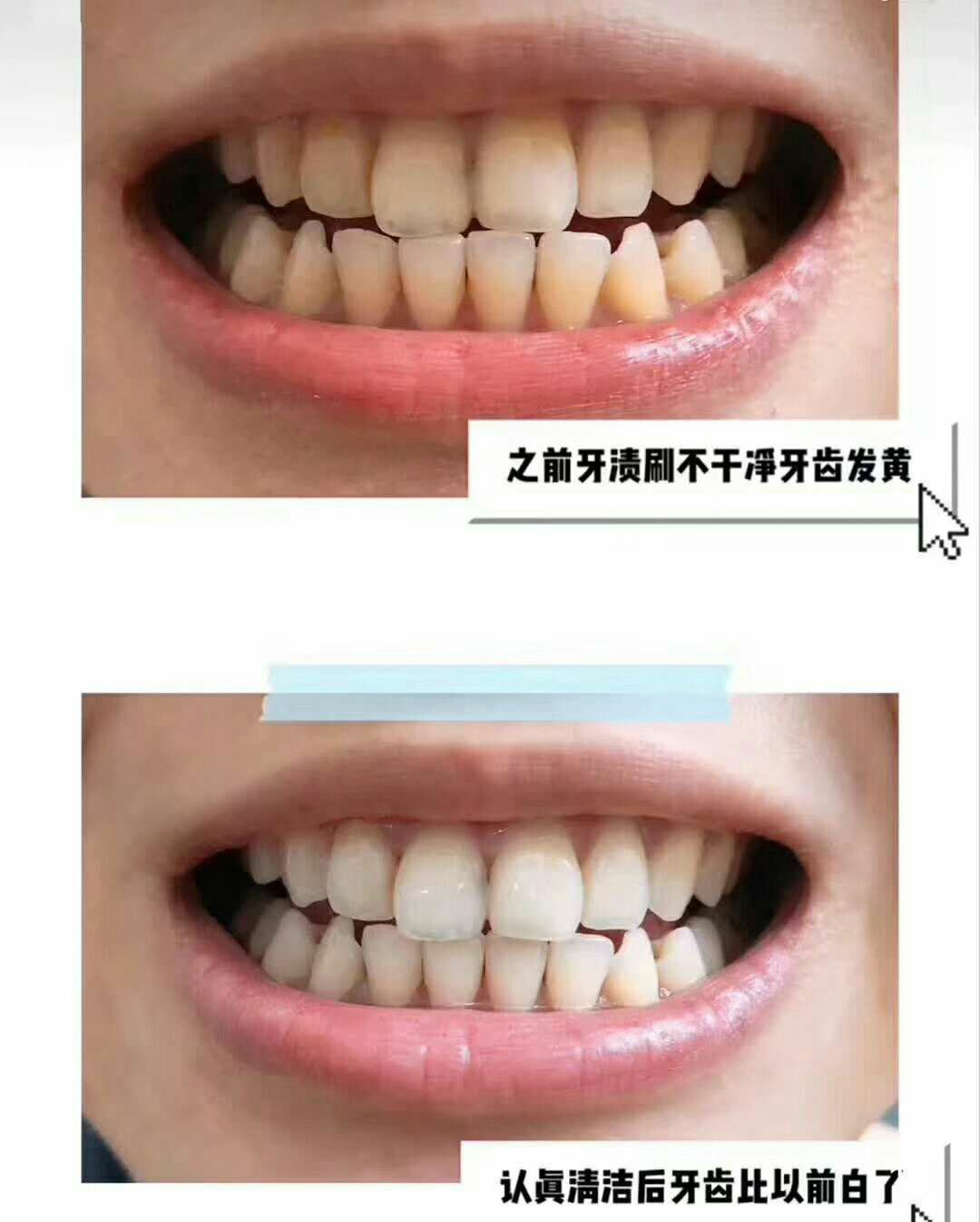 牙美清新洁白慕斯（南京同仁堂）