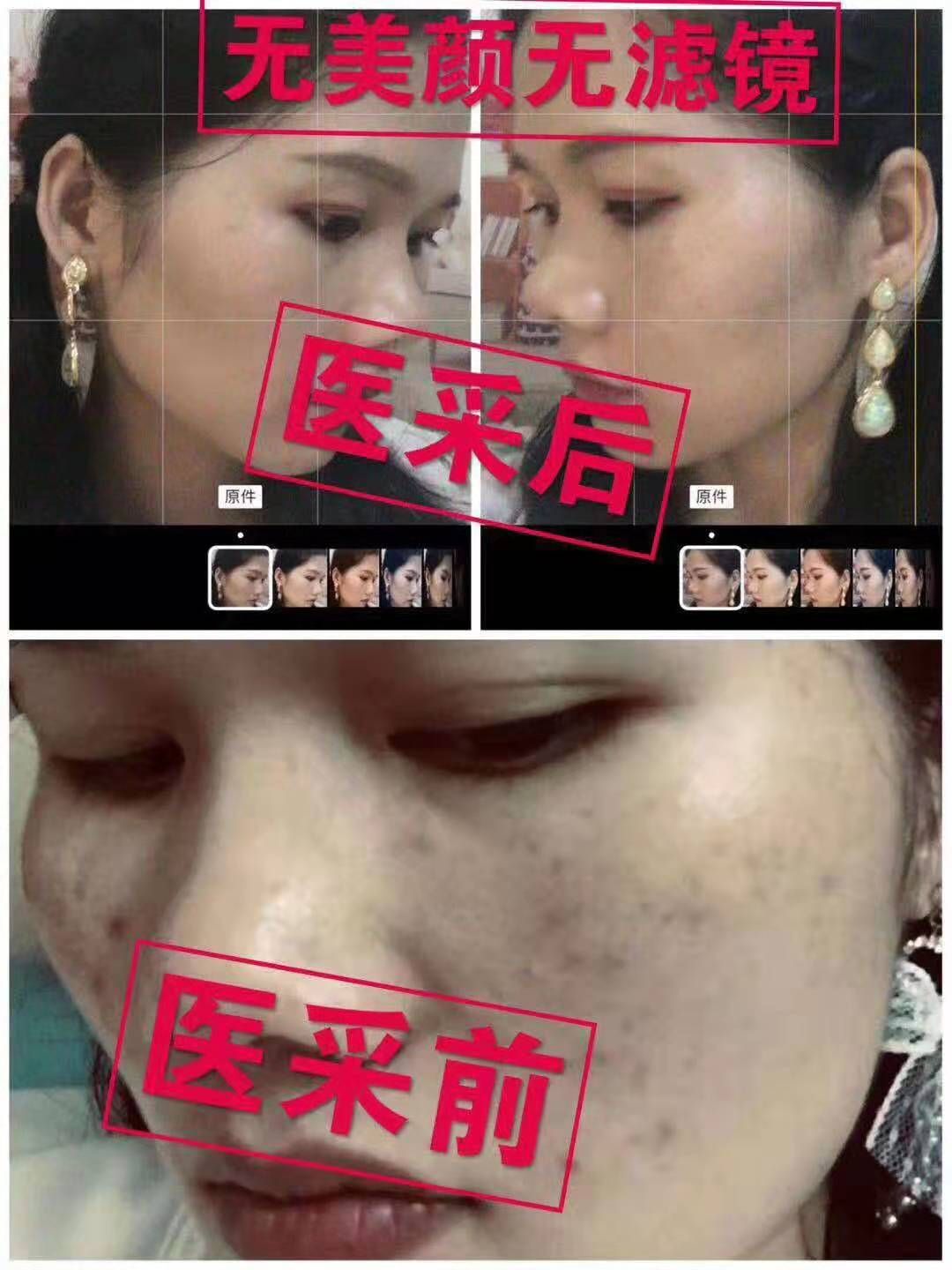 医采护肤品