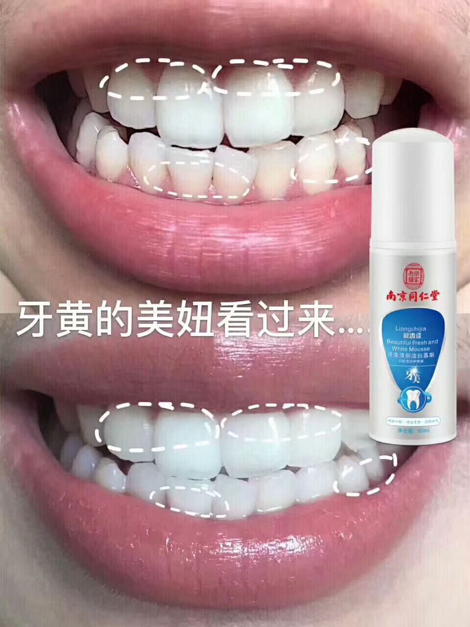 牙美清新洁白慕斯（南京同仁堂）