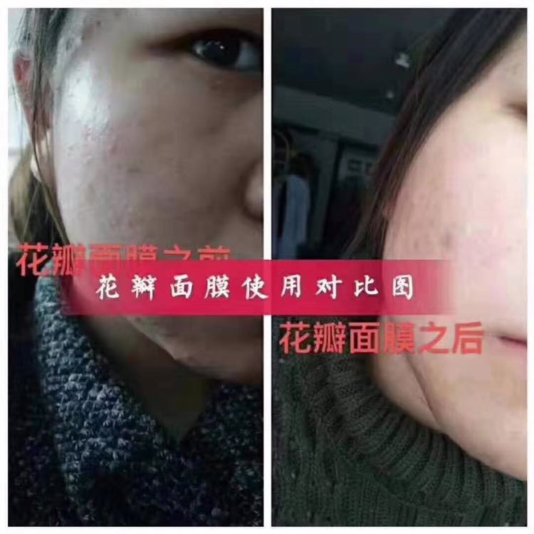 花瓣面膜产品