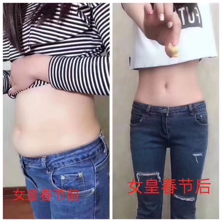 不用节食就能瘦的益生菌酵素软糖，男女老少皆宜，排毒养颜，瘦身