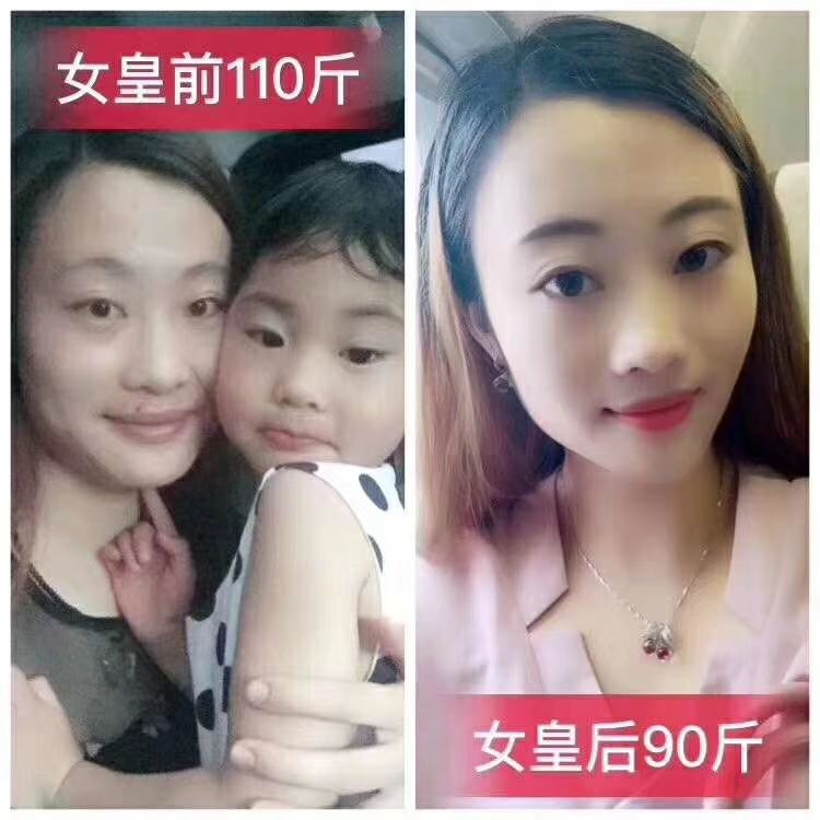 不用节食就能瘦的益生菌酵素软糖，男女老少皆宜，排毒养颜，瘦身