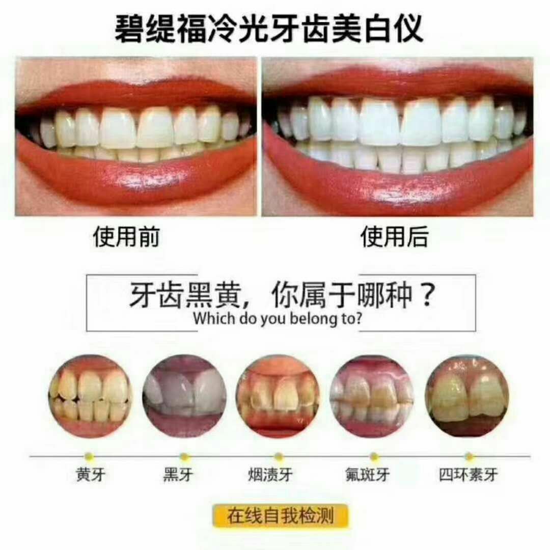 碧缇福美牙仪 7天见效15天无效退款