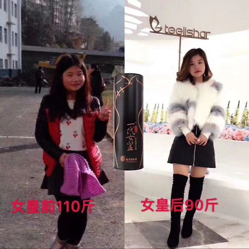 不用节食就能瘦的益生菌酵素软糖，男女老少皆宜，排毒养颜，瘦身