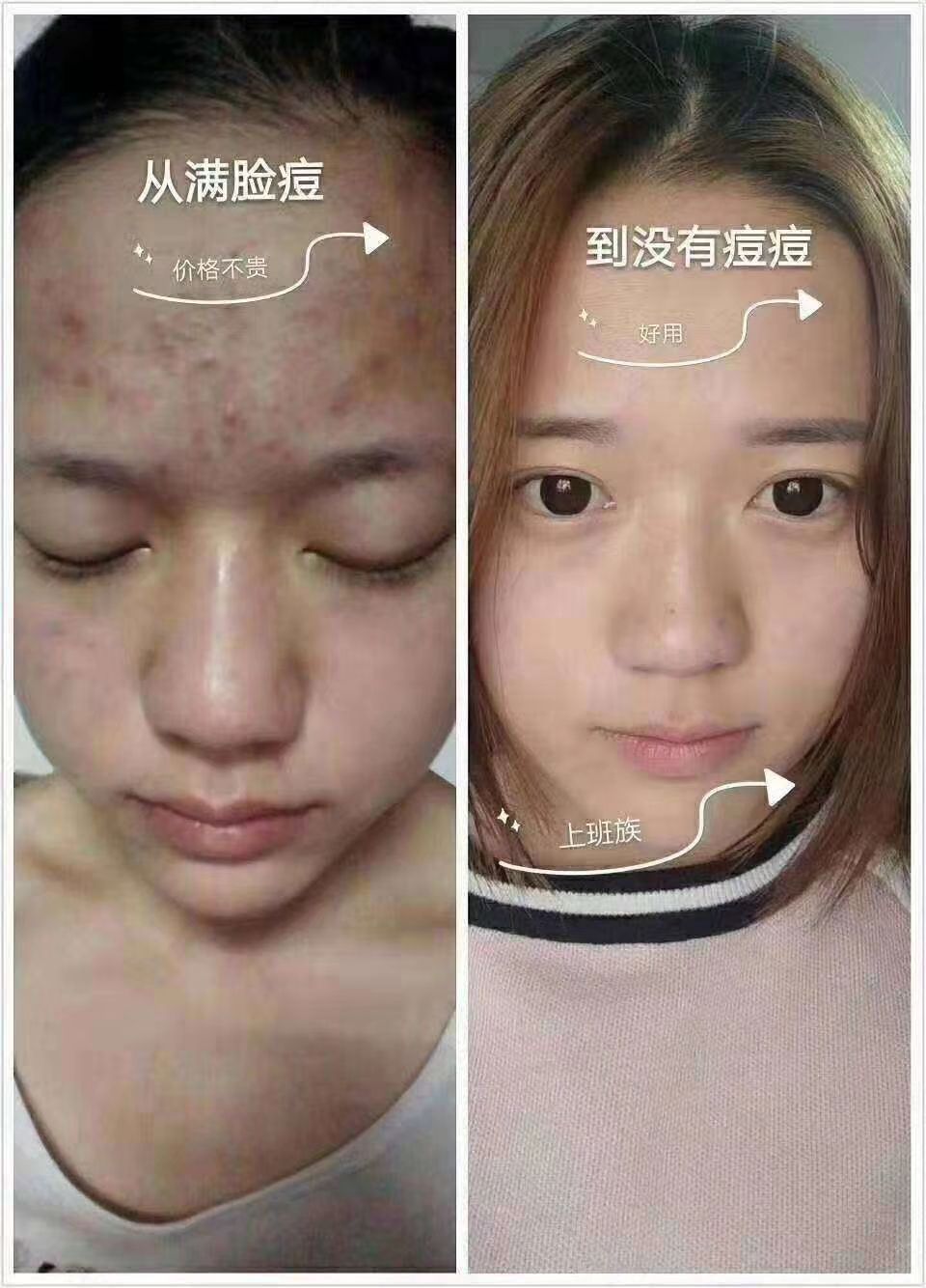 ❤️ 冰亦花瓣冰膜纯植物花瓣提取软膜粉，三分钟迅速成膜，