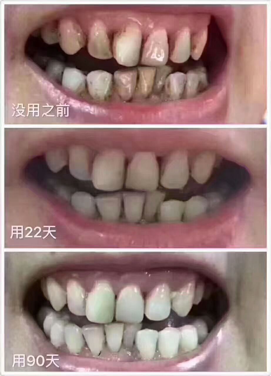 牙美清新洁白慕斯（南京同仁堂）