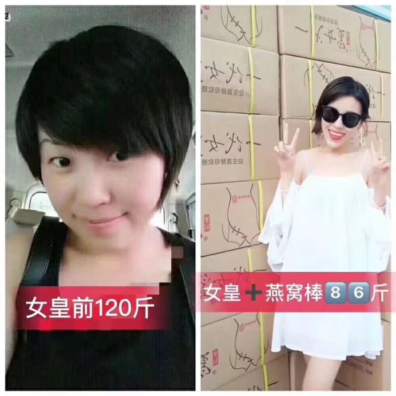 不用节食就能瘦的益生菌酵素软糖，男女老少皆宜，排毒养颜，瘦身