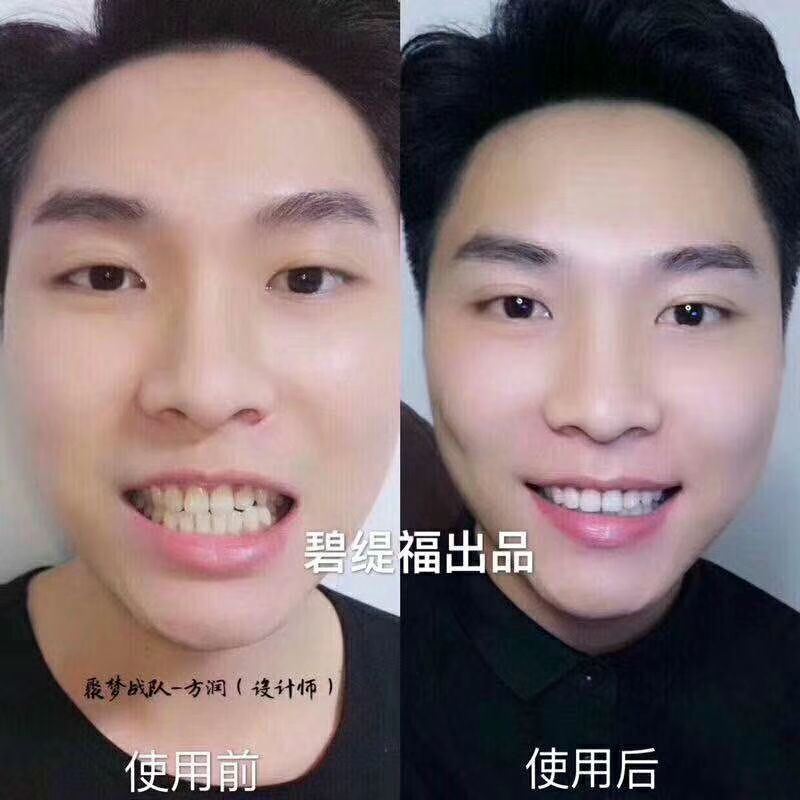 碧缇福美牙仪诚招代理，多少个黄牙就有多少个市场