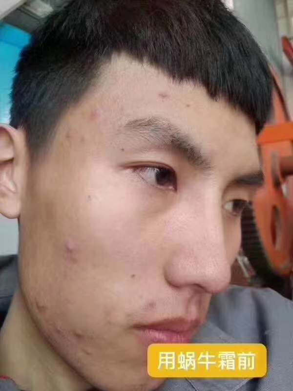艾璐卡护肤 小白面膜 一系列的使用让你变得更美