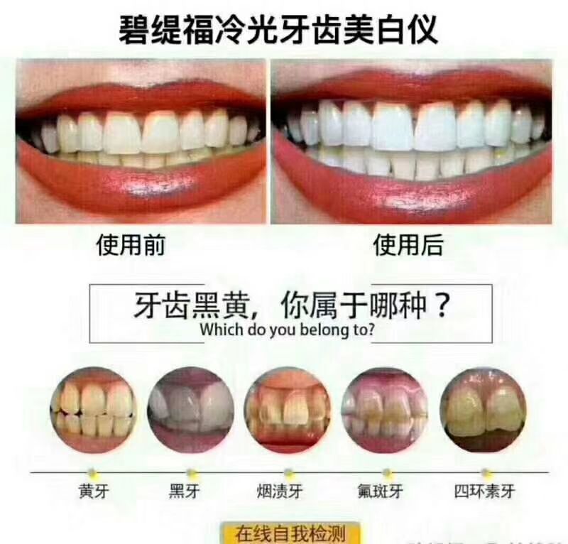 碧缇福美牙仪诚招代理，多少个黄牙就有多少个市场