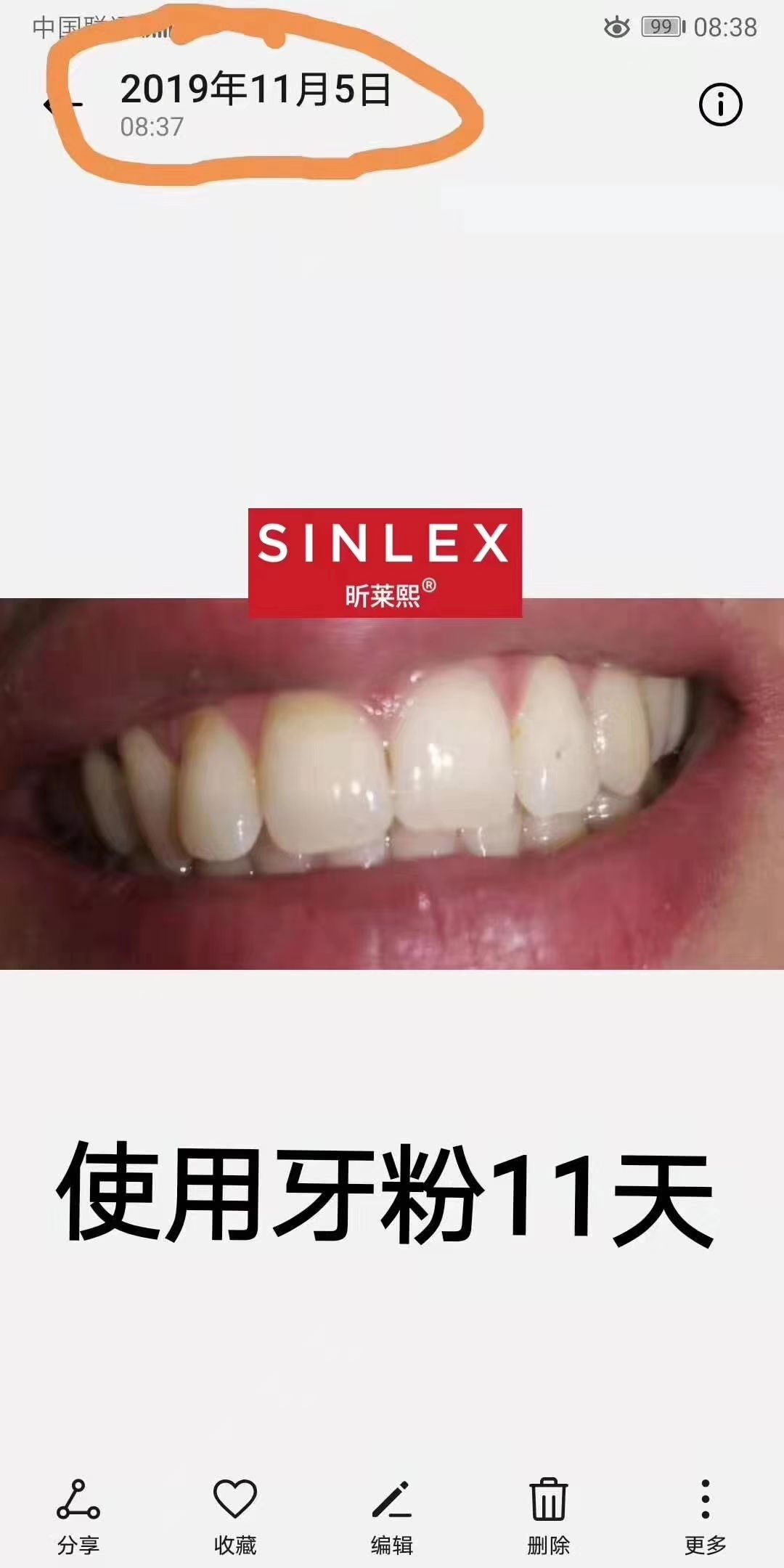 昕莱熙洁牙素 一旦用上就会爱上，评价又好用