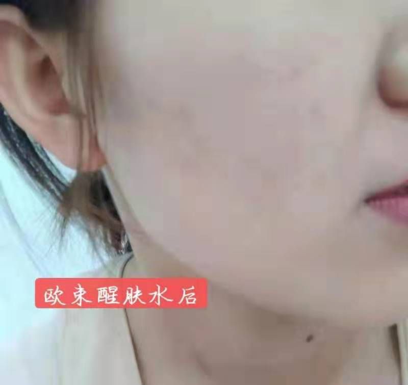 欧束让每个人都变美