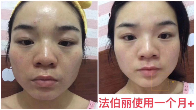法伯丽贵妇小金瓶（招代理）