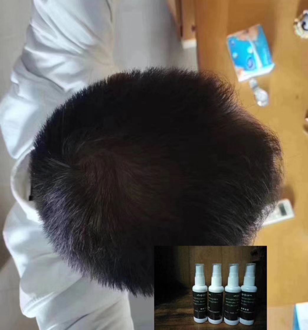 纯藏药生发液  遮暇霜   香水