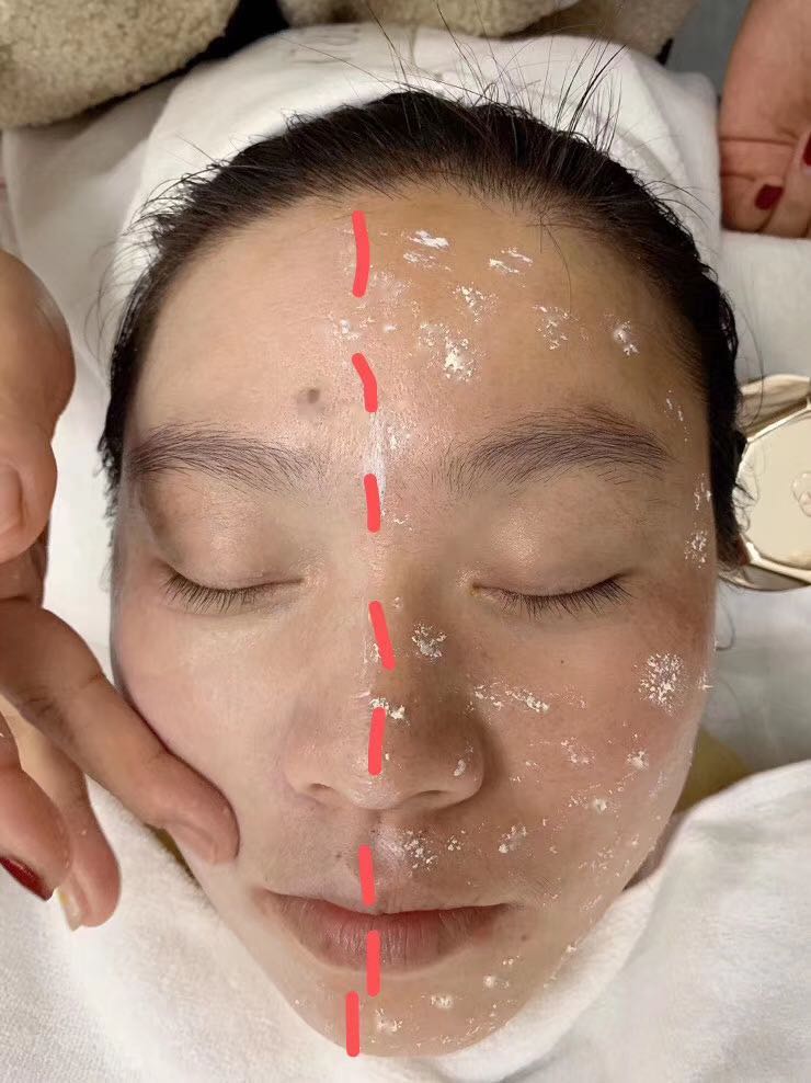 法伯丽贵妇小金瓶（招代理）