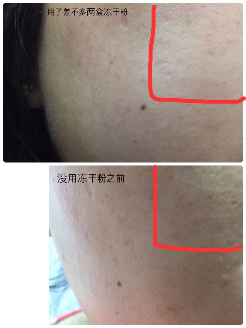 少女肌养成记 冻干粉
