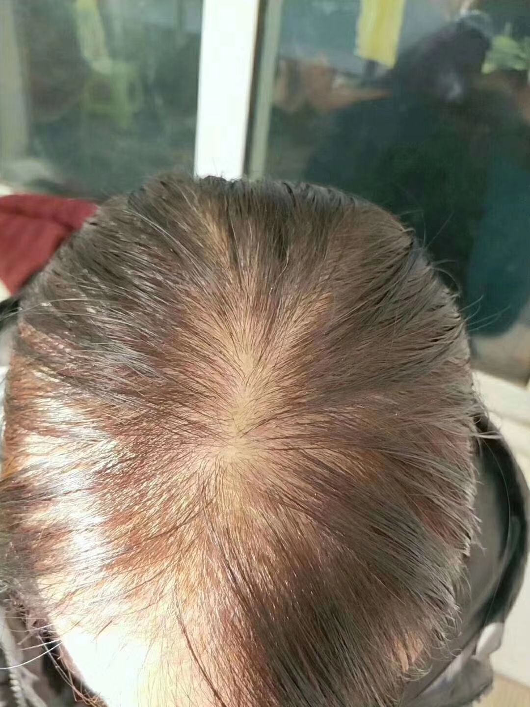 纯藏药生发液  遮暇霜   香水