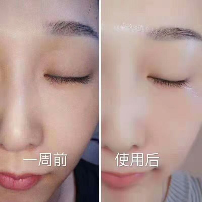 DHV钢铁侠面膜