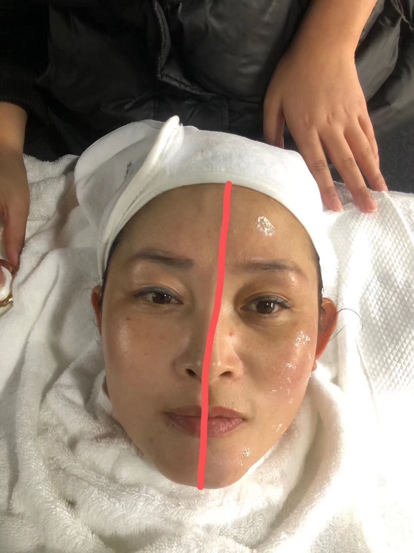 法伯丽贵妇小金瓶（招代理）