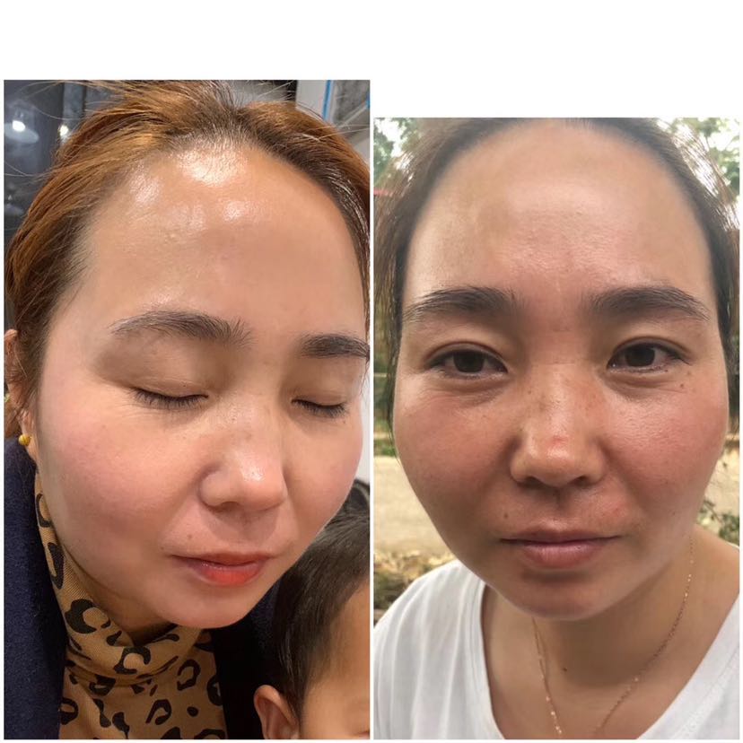 法伯丽贵妇小金瓶（招代理）
