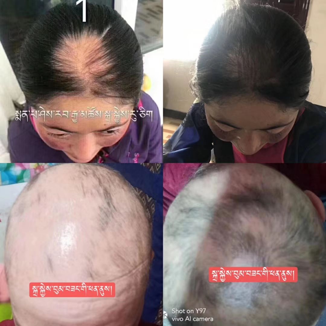 纯藏药生发液  遮暇霜   香水