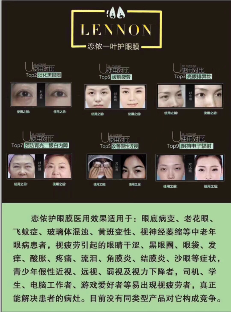 恋侬一眼护眼膜，火爆招商中