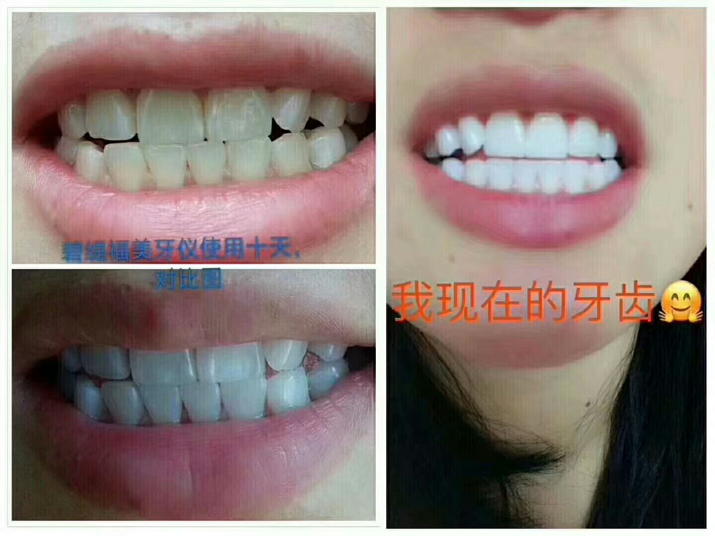 碧缇福美牙仪(诚招代理)