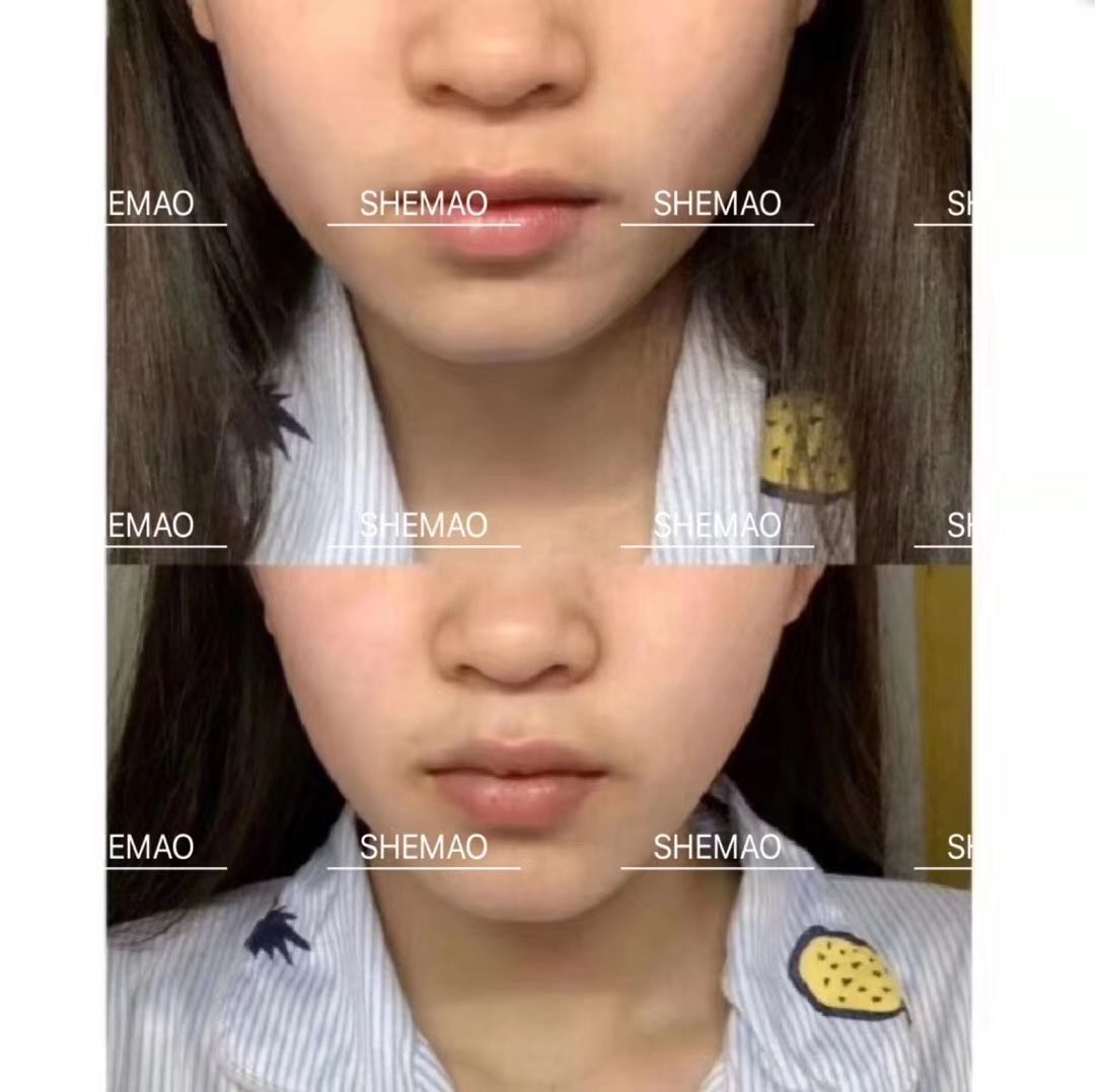 投资奢貌提拉紧致面膜，让你月入过万