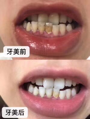 变白 变美 变瘦 变自信