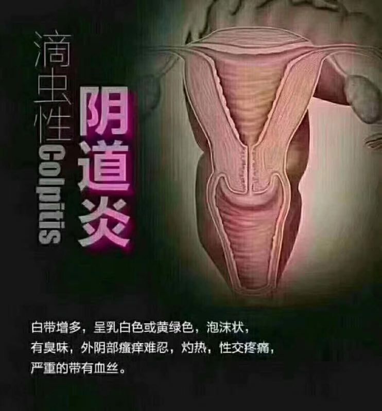 佳茵女人的保护伞