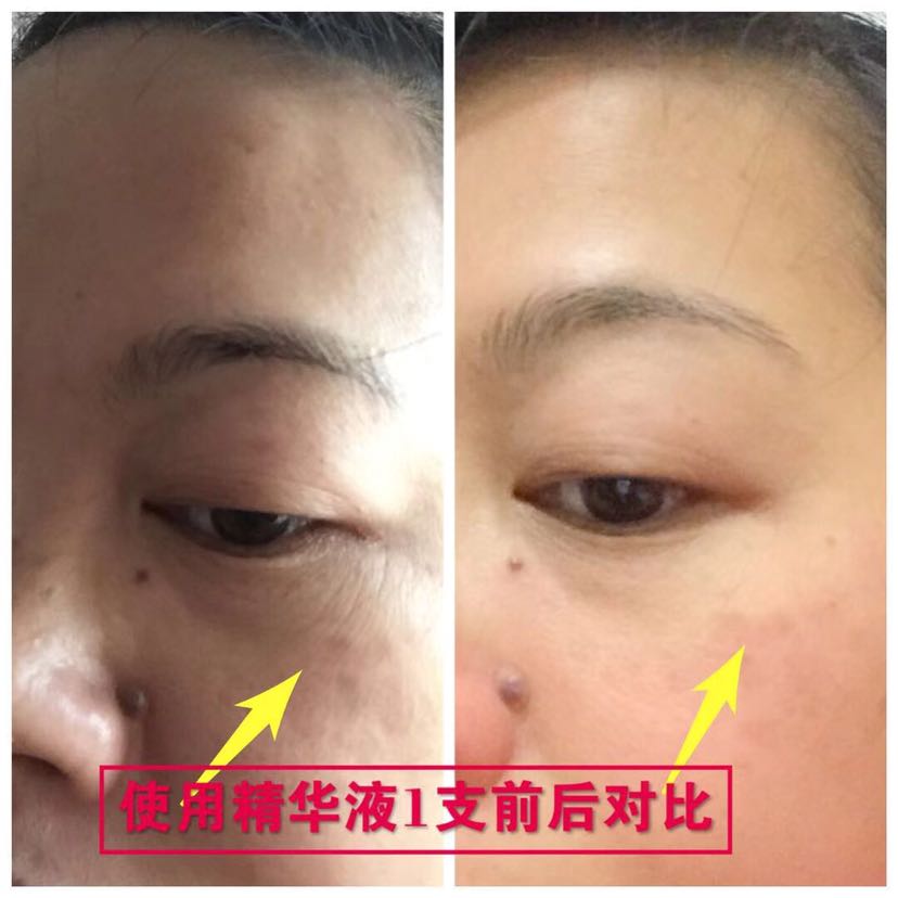 蓓俪芙养生精华原液