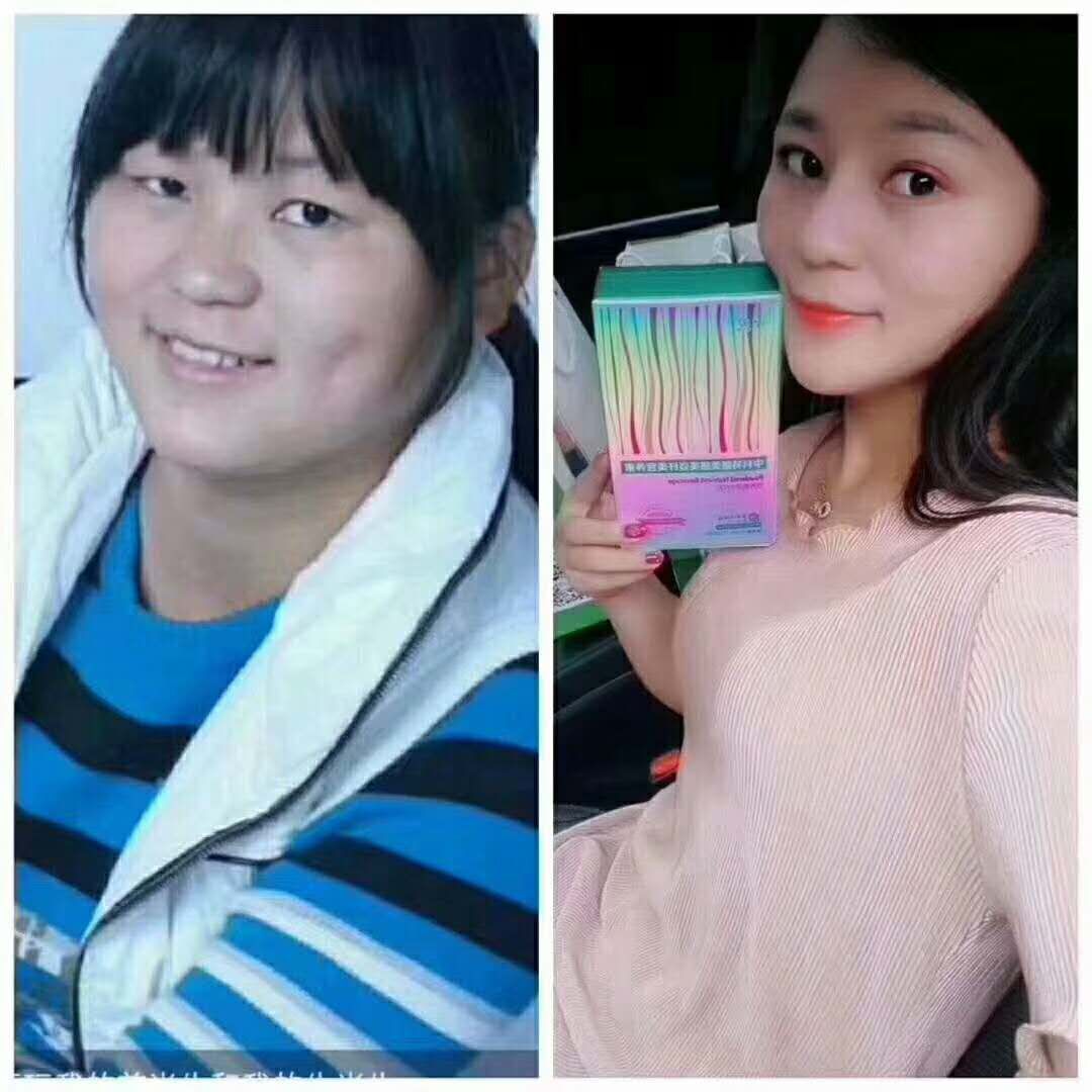 中科特膳美膳美姿纤美营养粉