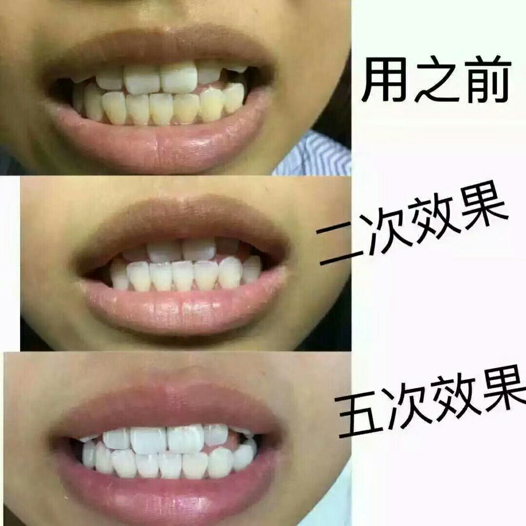 碧缇福美牙仪(诚招代理)