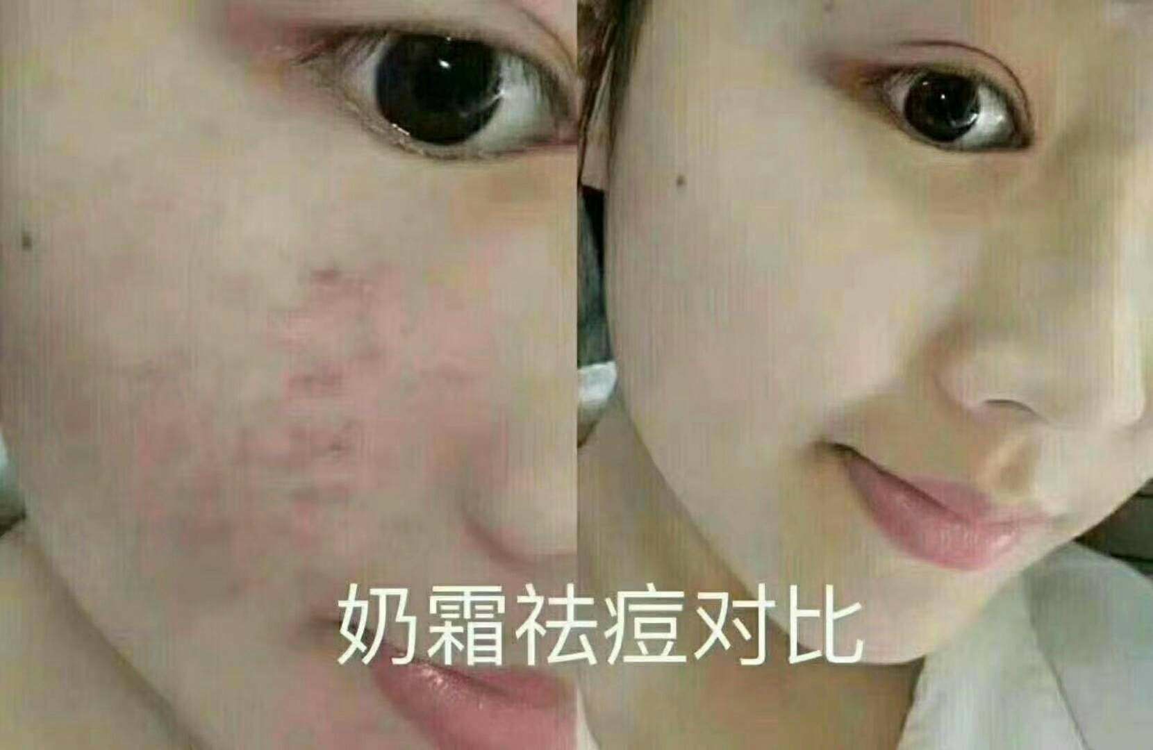 美白瘦身祛斑祛痘保湿护肤品❗❗