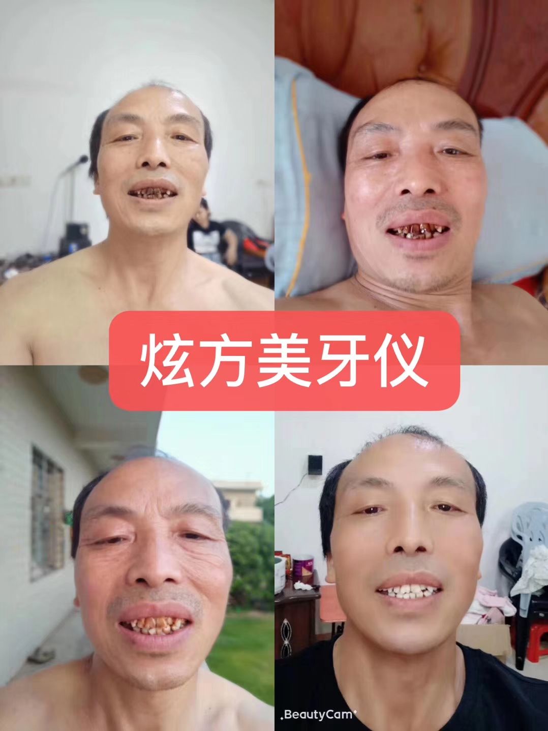 炫方冷光美牙