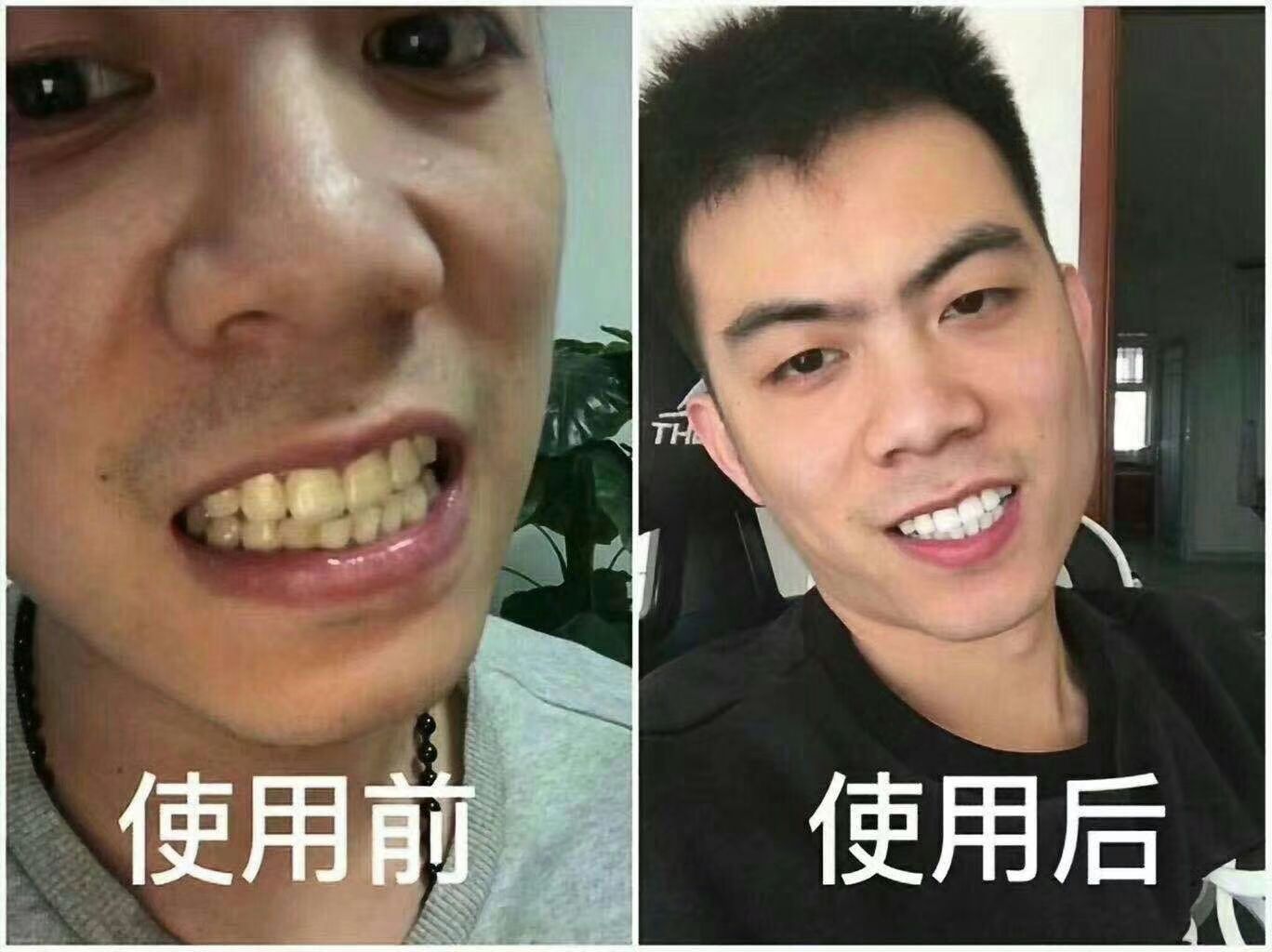 碧缇福美牙仪 七天还你大白牙